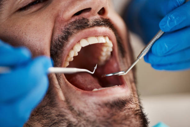 Best Full Mouth Reconstruction  in Woodsboro, MD