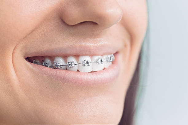 Best Teeth Whitening  in Woodsboro, MD